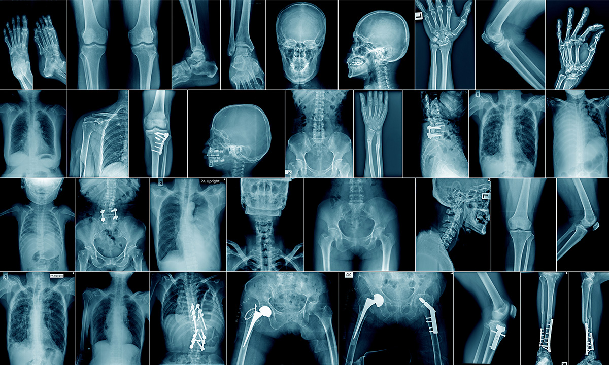 skeleton x-rays